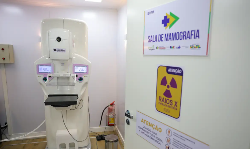 Cirurgias plásticas de mama pelo SUS crescem 54% em dez anos