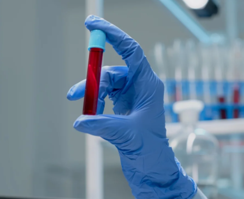 Novo exame de sangue que detecta mais de 50 tipos de câncer chega ao Brasil